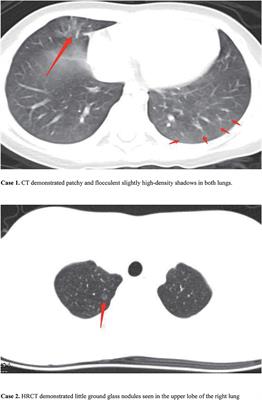 Are They Just Two Children COVID-19 Cases Confused With Flu?